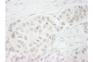 Immunohistochemistry (IHC) image for anti-Budding Uninhibited By Benzimidazoles 1 Homolog beta (Yeast) (BUB1B) (AA 1-50) antibody (ABIN7448450)