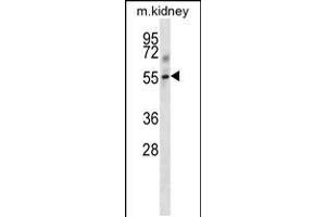 Western blot analysis in mouse kidney tissue lysates (35ug/lane).