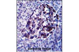 anti-Midline 2 (MID2) (AA 690-717), (C-Term) antibody