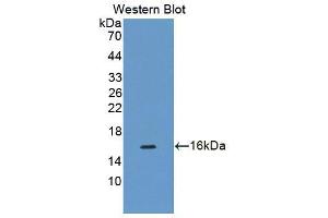 Western blot analysis of the recombinant protein. (CDK2AP1 anticorps  (AA 1-115))