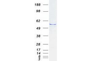 Validation with Western Blot