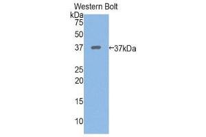 Western Blotting (WB) image for anti-Periplakin (PPL) (AA 1439-1716) antibody (ABIN1860294) (PPL anticorps  (AA 1439-1716))