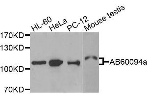 Western blot analysis of extracts of various cells, using ADAMTS5 antibody.