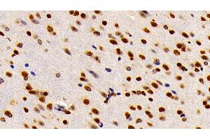 Detection of HMGB1 in Mouse Cerebrum Tissue using Polyclonal Antibody to High Mobility Group Protein 1 (HMGB1) (HMGB1 anticorps  (AA 1-215))