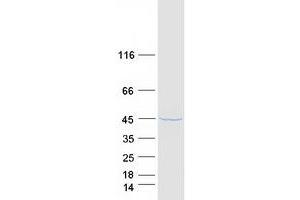 Validation with Western Blot