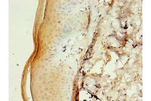 Immunohistochemistry of paraffin-embedded human skin tissue using ABIN7146503 at dilution of 1:100 (CALML5 anticorps  (AA 2-146))