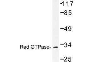 Image no. 1 for anti-RAS (RAD and GEM)-Like GTP-Binding 1 (REM1) antibody (ABIN317842) (REM1 anticorps)
