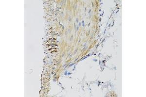 Immunohistochemistry of paraffin-embedded mouse stomach using DGUOK antibody (ABIN2562205) at dilution of 1:100 (40x lens).