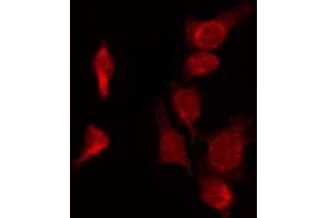 ABIN6272357 staining HepG2 by IF/ICC.