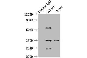 Immunoprecipitating SOD1 in HEK293 whole cell lysate Lane 1: Rabbit control IgG (1 μg) instead of ABIN7144580 in HEK293 whole cell lysate. (Liver Arginase anticorps  (AA 1-322))