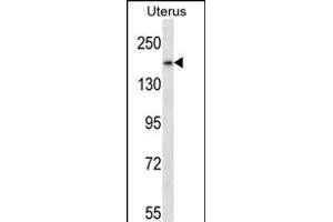 SMC1B Antibody (Center) (ABIN657773 and ABIN2846748) western blot analysis in human normal Uterus tissue lysates (35 μg/lane). (SMC1B anticorps  (AA 737-765))