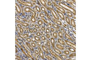 Immunohistochemistry of paraffin-embedded mouse kidney using [KO Validated] ST Rabbit pAb (ABIN6132553, ABIN6148568, ABIN6148571 and ABIN6215503) at dilution of 1:250 (40x lens).