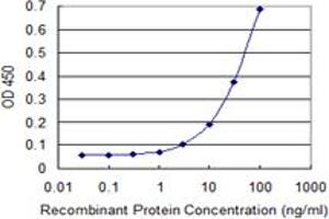 Detection limit for recombinant GST tagged ZKSCAN5 is 1 ng/ml as a capture antibody.