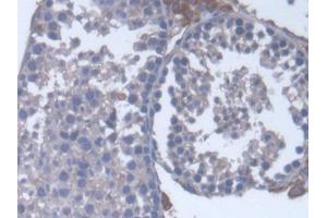 DAB staining on IHC-P; Samples: Mouse Testis Tissue (CYP17A1 anticorps  (AA 201-507))