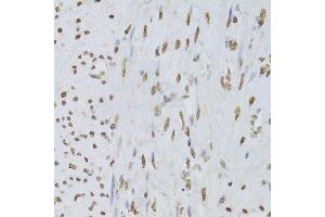 Immunohistochemistry of paraffin-embedded human leiomyoma of uterus using HNRNPD Antibody.
