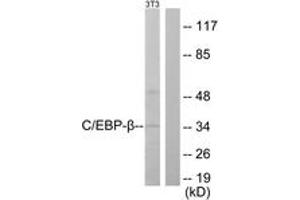 Western blot analysis of extracts from NIH-3T3 cells, using C/EBP-beta (Ab-235/188) Antibody. (CEBPB anticorps  (AA 201-250))