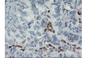 Image no. 2 for anti-Myosin Light Chain 7, Regulatory (MYL7) antibody (ABIN1499491)