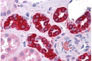 Human Kidney: Formalin-Fixed, Paraffin-Embedded (FFPE) (AGR3 anticorps)