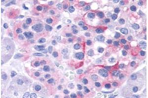 Anti-TRPV4 antibody  ABIN1049441 IHC staining of human pancreas, islet. (TRPV4 anticorps  (Internal Region))