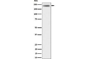 Western blot analysis of DENN expression in HeLa cell lysate.