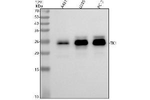 Western blot analysis of Thymidine Kinase 1 using anti-Thymidine Kinase 1 antibody (ABIN7606500).