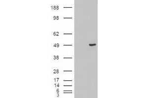 Image no. 13 for anti-Keratin 18 (KRT18) (AA 69-372) antibody (ABIN1491637)