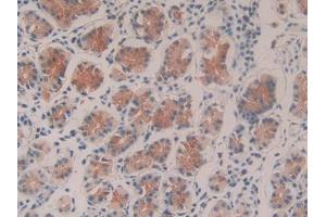 DAB staining on IHC-P; Samples: Human Stomach Tissue (Caspase 9 anticorps  (AA 331-416))