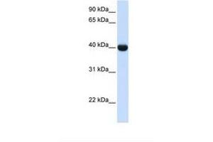 Image no. 1 for anti-Alcohol Dehydrogenase 1A (Class I), alpha Polypeptide (ADH1A) (AA 108-157) antibody (ABIN6737999) (ADH1A anticorps  (AA 108-157))