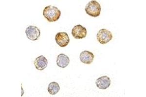 Immunohistochemistry (IHC) image for anti-Disrupted in Schizophrenia 1 (DISC1) (Middle Region) antibody (ABIN1030920) (DISC1 anticorps  (Middle Region))
