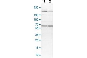 Western blot analysis of Lane 1: NIH-3T3 cell lysate (Mouse embryonic fibroblast cells) Lane 2: NBT-II cell lysate (Rat Wistar bladder tumour cells) with USP14 polyclonal antibody  at 1:100-1:250 dilution. (USP14 anticorps)