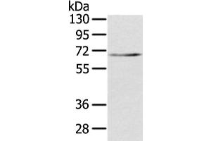 Western Blotting (WB) image for anti-Transducin (Beta)-Like 1X-Linked (TBL1X) antibody (ABIN5961943) (TBL1X anticorps)