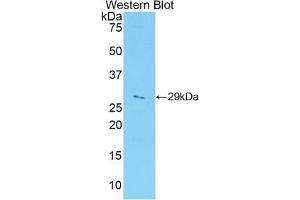 Western blot analysis of the recombinant protein. (ADAM5 anticorps  (AA 413-649))