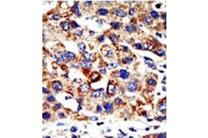Image no. 1 for anti-Histone Deacetylase 8 (HDAC8) (N-Term) antibody (ABIN356653) (HDAC8 anticorps  (N-Term))