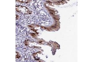 Immunohistochemical staining of human rectum with MUC13 polyclonal antibody  shows strong cytoplasmic positivity in goblet cells.