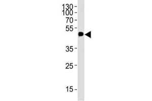 Western blot analysis of lysate from 12-Tag protein using c-Myc antibody; Ab was diluted at 1:4000. (Myc Tag anticorps  (AA 408-439))