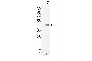 Western blot analysis of CDX2(arrow) using rabbit polyclonal CDX2 Antibody (N-term) (ABIN390076 and ABIN2840597). (CDX2 anticorps  (N-Term))