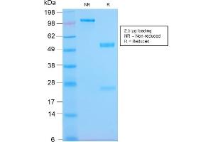 SDS-PAGE Analysis Purified HLA-Pan Rabbit Recombinant Monoclonal (HLA-Pan/2967R).