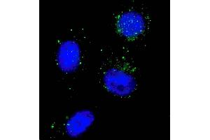 Fluorescent image of  cells stained with Beclin 1 antibody.