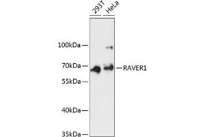 anti-Ribonucleoprotein, PTB-Binding 1 (RAVER1) (AA 390-490) antibody