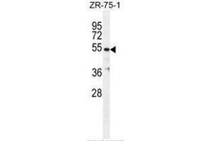 TBB1 Antibody (N-term) western blot analysis in ZR-75-1 cell line lysates (35µg/lane). (TUBB1 anticorps  (N-Term))