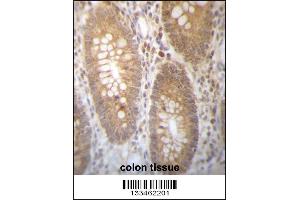 DHRS7B Antibody immunohistochemistry analysis in formalin fixed and paraffin embedded human colon tissue followed by peroxidase conjugation of the secondary antibody and DAB staining. (DHRS7B anticorps  (AA 133-161))