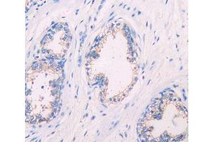 IHC-P analysis of prostate gland tissue, with DAB staining. (SIGIRR anticorps  (AA 1-118))