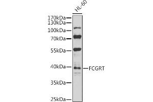 Western blot analysis of extracts of HL-60 cells, using FCGRT antibody (ABIN6127922, ABIN6140552, ABIN6140553 and ABIN6224639) at 1:1000 dilution. (FcRn anticorps  (AA 25-300))