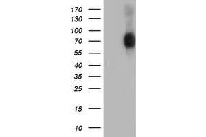 Western Blotting (WB) image for anti-SH2B Adaptor Protein 3 (SH2B3) antibody (ABIN1500910) (SH2B3 anticorps)