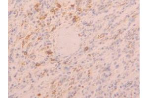 IHC-P analysis of Human Spleen Tissue, with DAB staining. (TLR5 anticorps  (AA 693-858))
