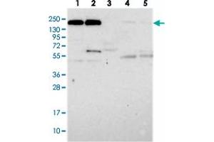 Western blot analysis of Lane 1: RT-4, Lane 2: U-251 MG, Lane 3: Human Plasma, Lane 4: Liver, Lane 5: Tonsil with DOCK3 polyclonal antibody  at 1:250-1:500 dilution. (DOCK3 anticorps)