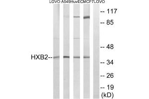 Western blot analysis of extracts from LOVO cells, A549 cells, HUVEC cells and MCF-7 cells, using HOXB2 antibody. (HOXB2 anticorps  (Internal Region))