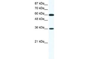 WB Suggested Anti-FOXF1 Antibody Titration: 1. (FOXF1 anticorps  (N-Term))