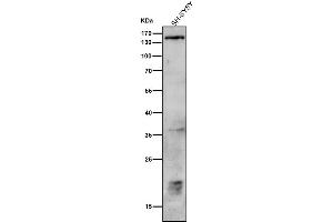 All lanes use the Antibody at 1:1K dilution for 1 hour at room temperature.