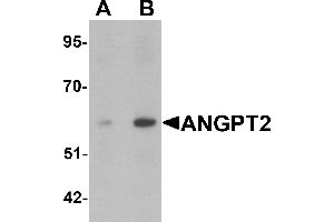 Western blot analysis of ANGPT2 in human liver tissue lysate with ANGPT2 antibody at (A) 1 and (B) 2 µg/mL. (Angiopoietin 2 anticorps  (C-Term))